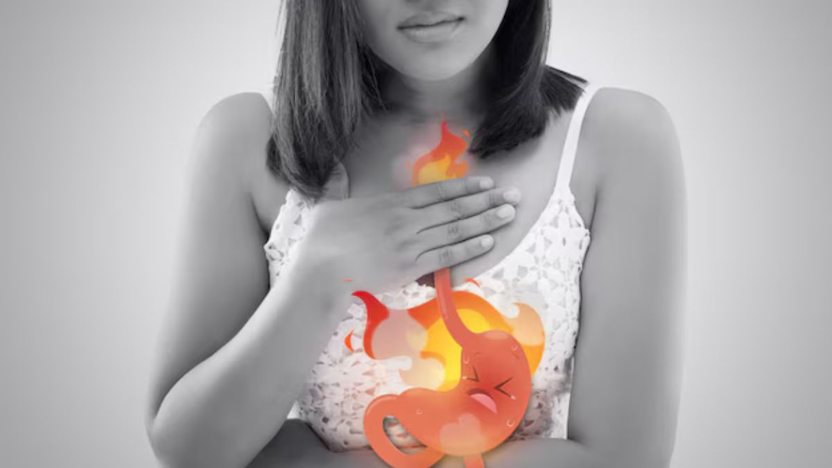 இந்த 3 பொருள்கள் போதும்.. அசிடிட்டியிலிருந்து நொடியில் நிவாரணம் பெறலாம்! மருத்துவர் ஹன்சாஜி விளக்கம்