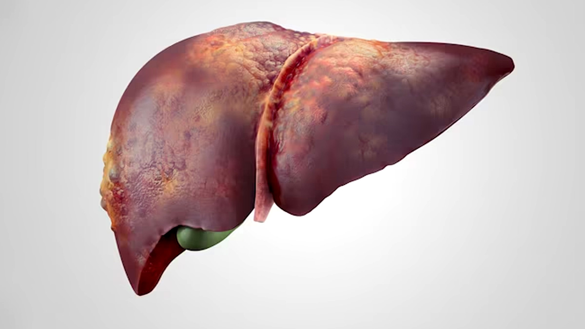 World Hepatitis Day 2023: கர்ப்பிணிகளை ஹெபடைடிஸ் எவ்வாறு பாதிக்கிறது தெரியுமா?