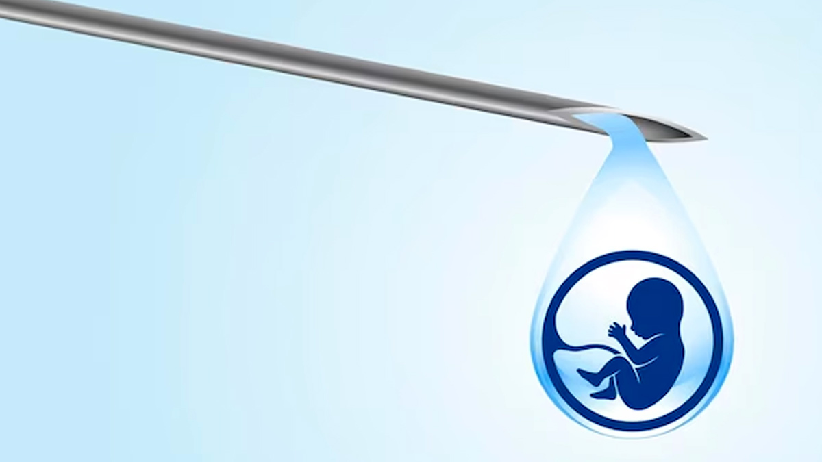 நீங்க IVF செய்ய விரும்புகிறீர்களா.. இந்த விஷயங்களில் கவனமாக இருங்க!