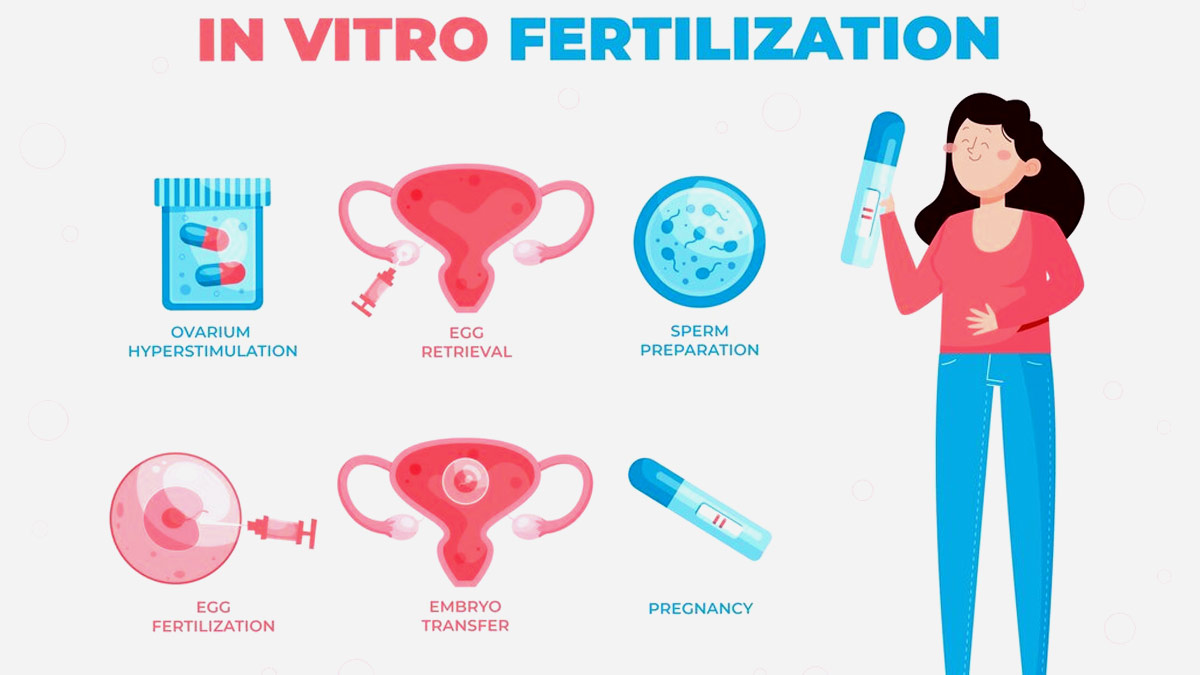 IVF என்றால் என்ன? -சிகிச்சை பற்றிய முழு விவரம் இதோ!