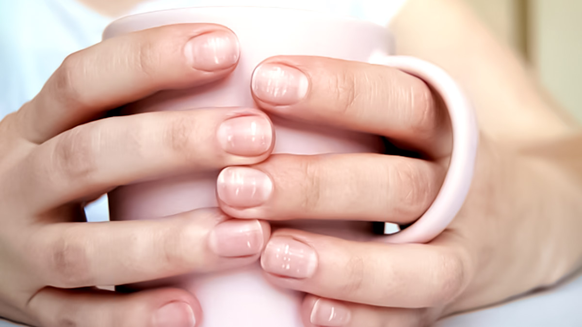 White Spots on Nails: What Causes Them & How to Treat - Tua Saúde