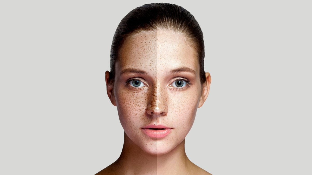 Potato for Skin Whitening: வெயிலால் முகம் ரொம்ப கறுப்பாகிடுச்சா? அப்போ உருளைக்கிழங்கை இப்படி யூஸ் பண்ணுங்க!