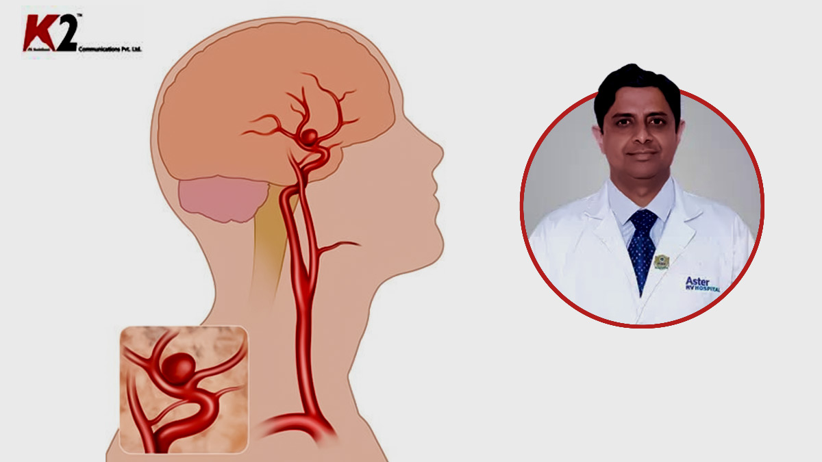 Brain Aneurysm: மூளை அனீரிசம் என்றால் என்ன? அதன் அறிகுறிகள், காரணங்கள், மற்றும் சிகிச்சை முறைகள் என்ன?