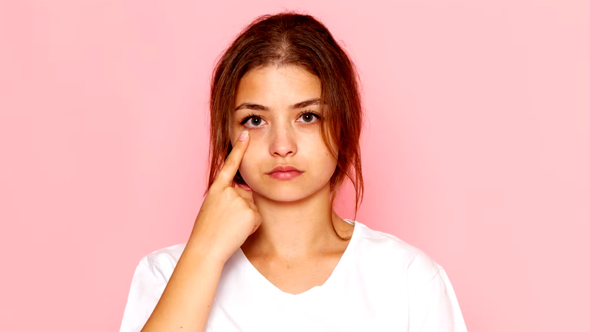 Dark Circles Causes: கருவளையத்திற்கு காரணம் தூக்கமின்மை மட்டும் அல்ல; இந்த நோய்களும் தான்!