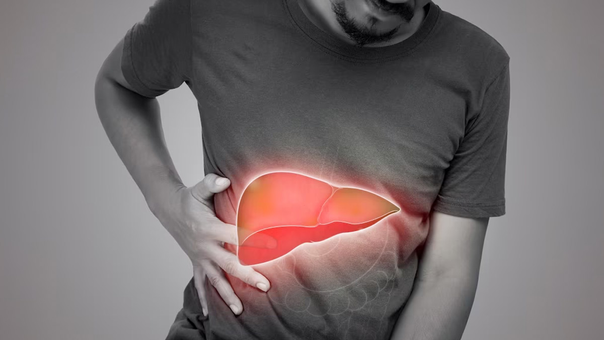 Fatty Liver Effects: கொழுப்பு கல்லீரலால் ஏற்படும் ஆபத்துக்கள் என்னென்ன தெரியுமா?
