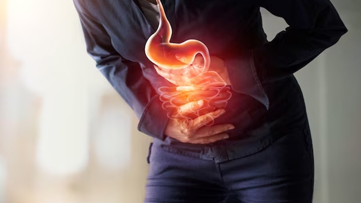 Inflammatory Bowel Diseases: மன அழுத்தத்தால் ஏற்படும் குடல் அழற்சி நோய்களை எவ்வாறு சமாளிப்பது?