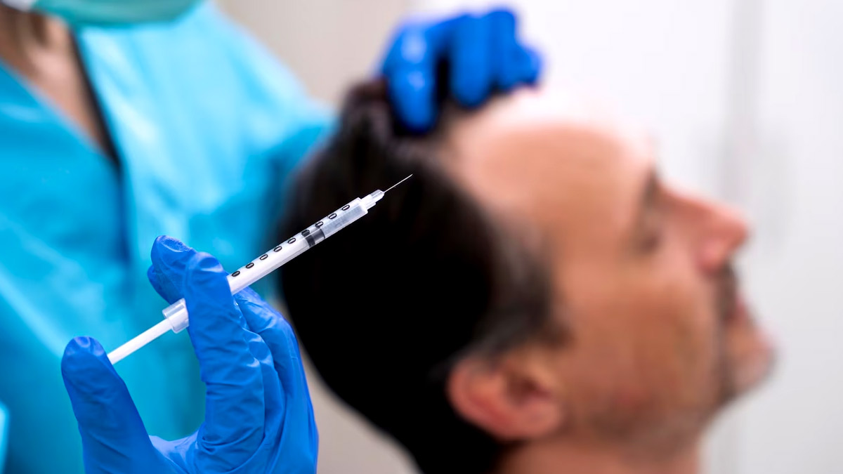 Hair Transplant Myths: முடி மாற்று அறுவை சிகிச்சை பற்றி மக்களிடையே நிலவும் கட்டுக்கதைகள்