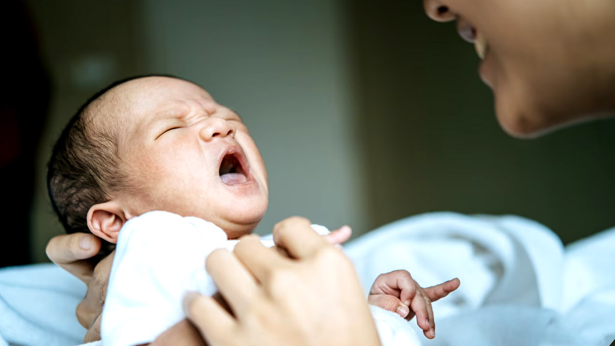 Newborn Jaundice: பிறந்த குழந்தைகளுக்கு வரும் மஞ்சள் காமாலை நோயின் அறிகுறிகள்