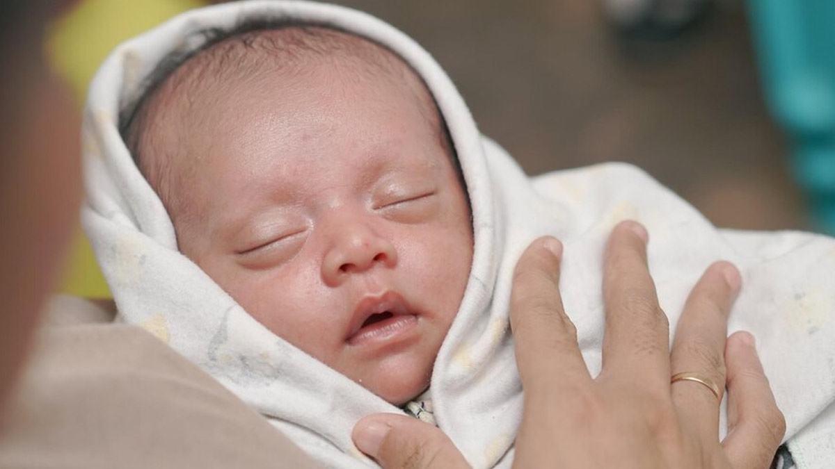 Newborn Jaundice Treatment: பிறந்த குழந்தைகளின் மஞ்சள் காமாலைக்கான இயற்கை சிகிச்சை முறைகள்