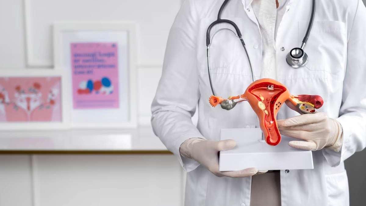 Ovarian Cyst: கருப்பை நீர்க்கட்டிகளின் அறிகுறிகள் மற்றும் சிகிச்சை முறைகள்