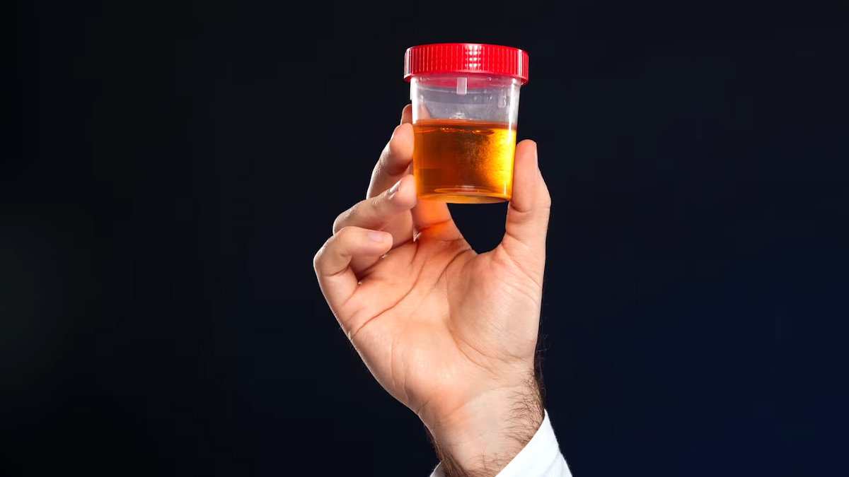 Blood in Urine: சிறுநீருடன் இரத்தம் கலந்து வருகிறதா? சிவப்பு நிறத்தில் சிறுநீர் வர காரணங்கள்!