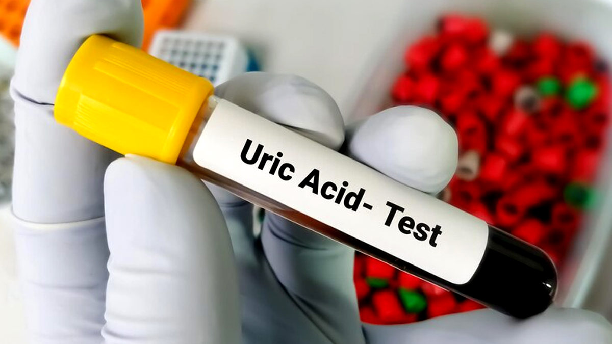 Uric Acid Control Foods: எந்த உணவுகள் யூரிக் அமிலத்தை கட்டுப்படுத்தும்?