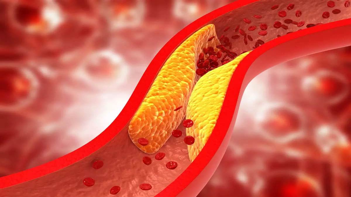 Cholesterol : ஓவர் கொலஸ்ட்ரால் உடம்புக்கு நல்லதில்ல பாஸ்… உடனே இந்த 3 விஷயங்கள கையில் எடுங்க!
