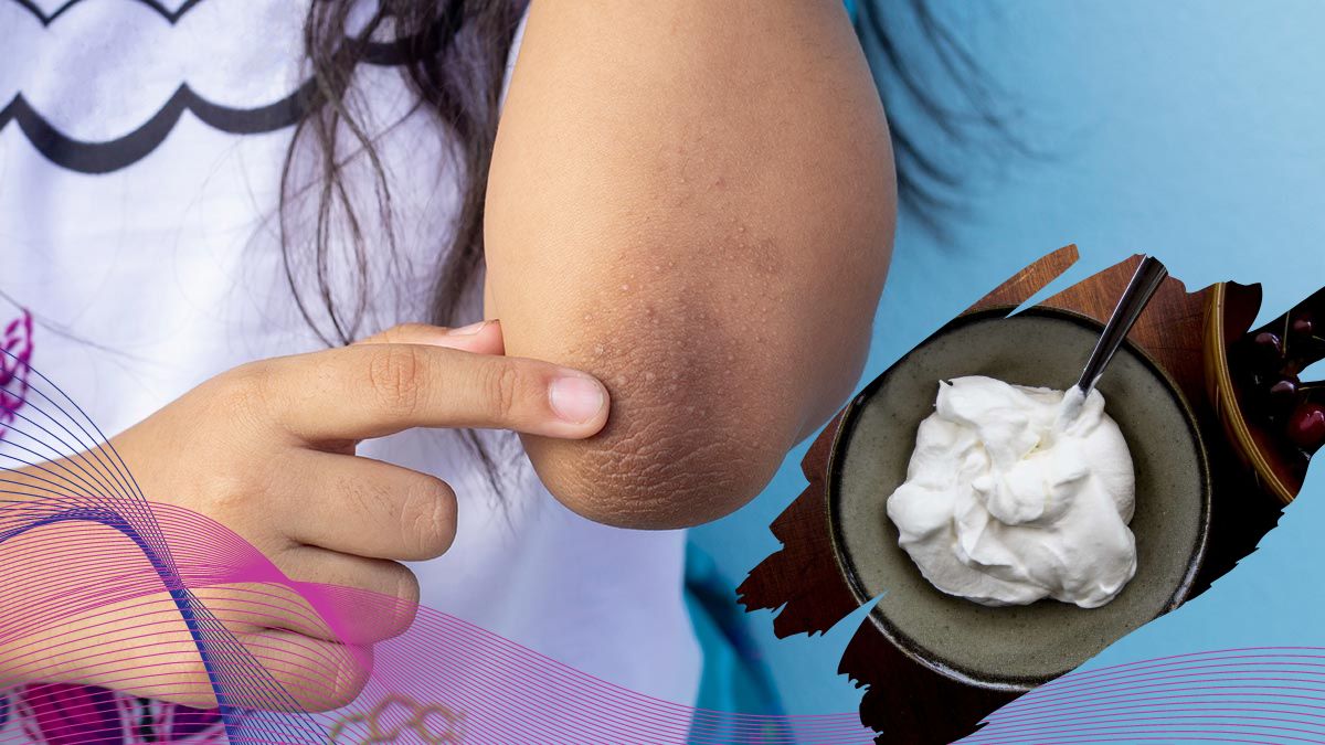 Remedies for Dark Elbows: முழங்கை மற்றும் முழங்கால்களில் உள்ள கருமையை நீக்க சூப்பர் வீட்டு வைத்தியம்!