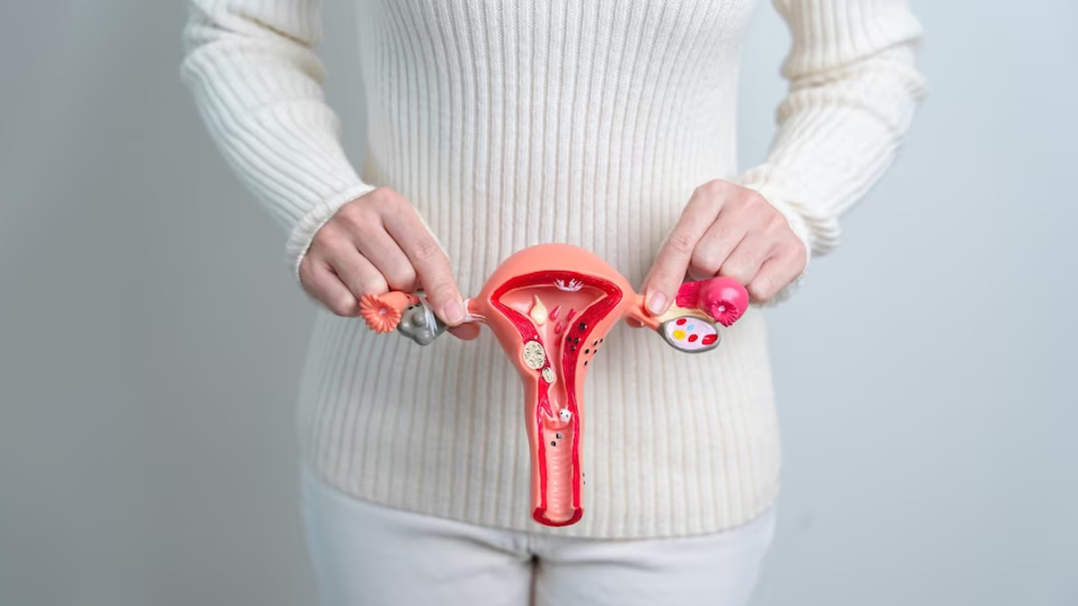 PCOS ஆல் முகத்தில் தேவையற்ற முடி அதிகரிக்கிறதா? நிவாரணம் பெற இதை செய்யுங்க!