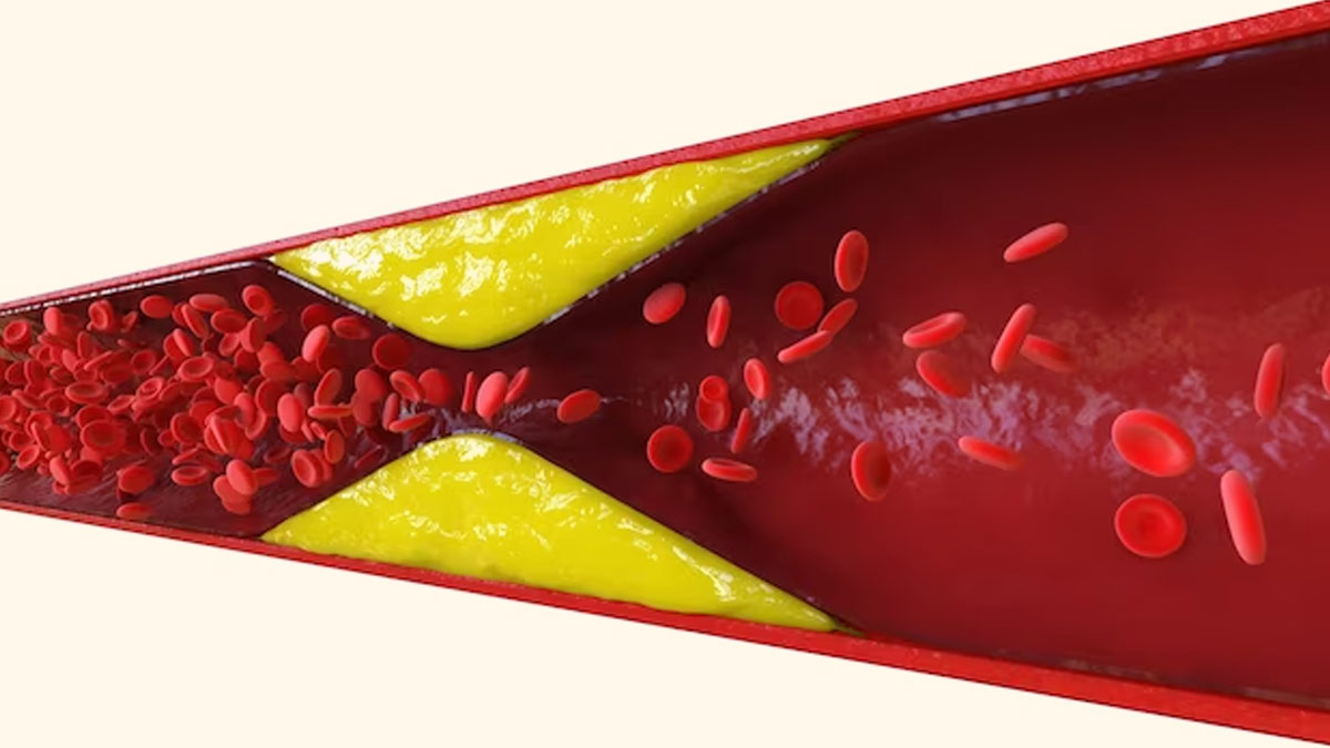 Cholesterol Control Tips: கெட்ட கொழுப்பு ஈஸியா குறைய இத பாளோ பண்ணுங்க!