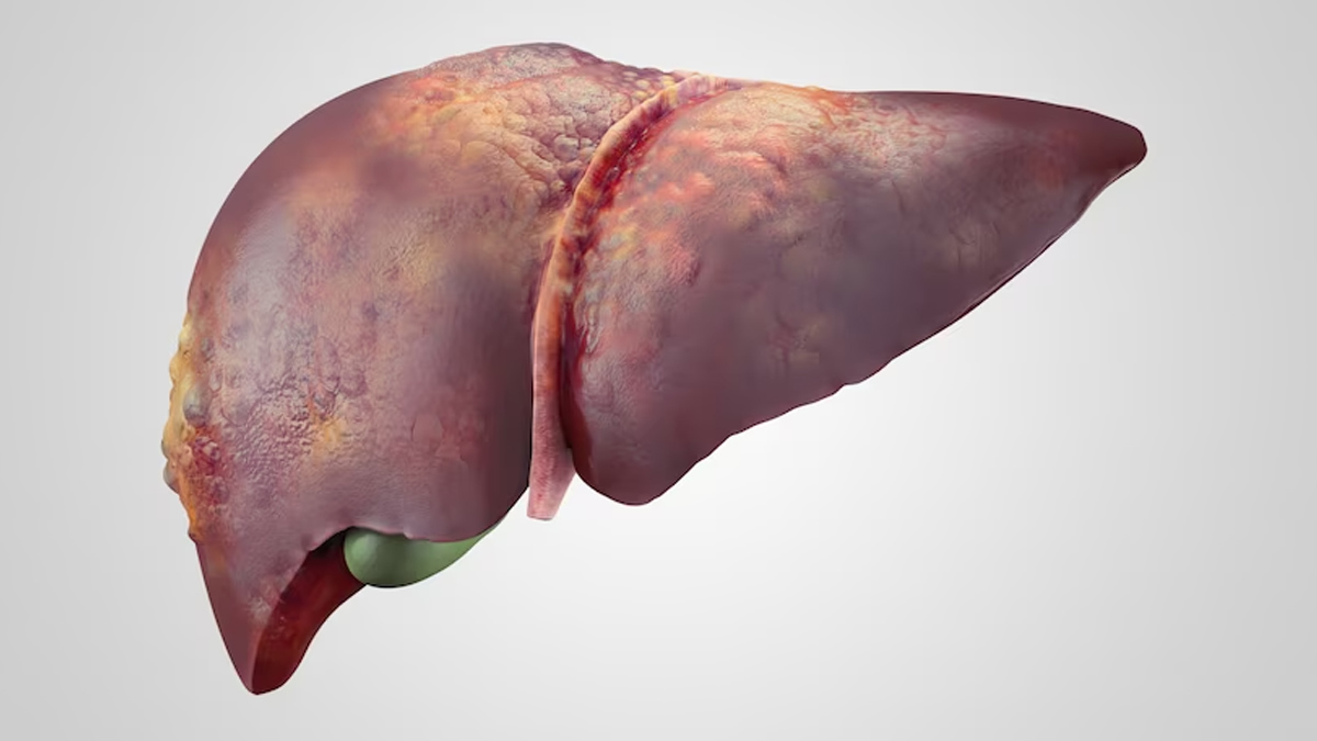 World Liver Day 2024: உடல் ஆரோக்கியத்திற்கு கல்லீரல் எவ்வளவு முக்கியம்? பாதிப்பு அறிகுறிகள் என்ன?