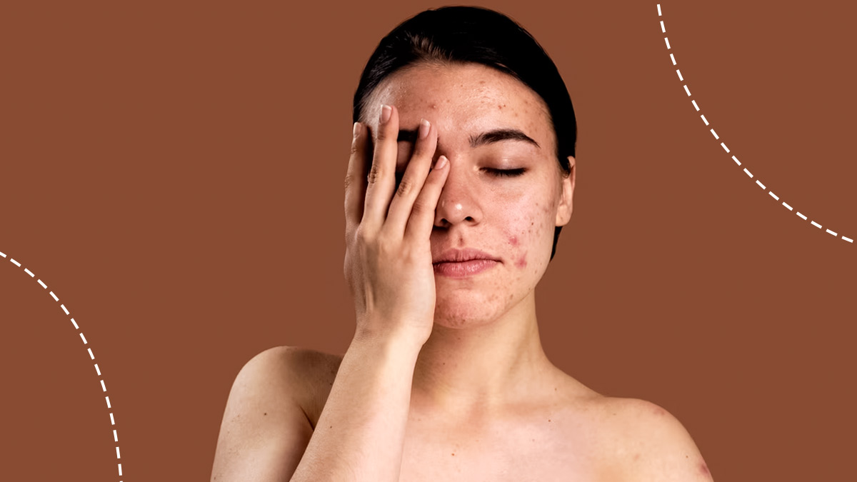Skin Care Tips: ஸ்கின் அலர்ஜி இருந்தால் மறந்தும் இந்த 5 தவறுகளை செய்யாதீர்கள்!!
