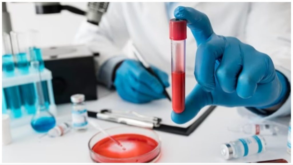 can-diabetic-patients-donate- blood