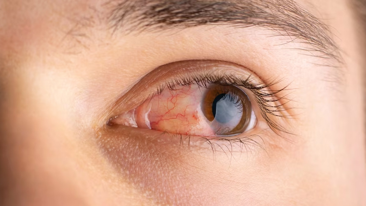 Eye Safety Tips: டிஜிட்டல் யுகம் பாஸ்.! கண்களை ஆரோக்கியமாக வைப்பது மிக முக்கியம்..