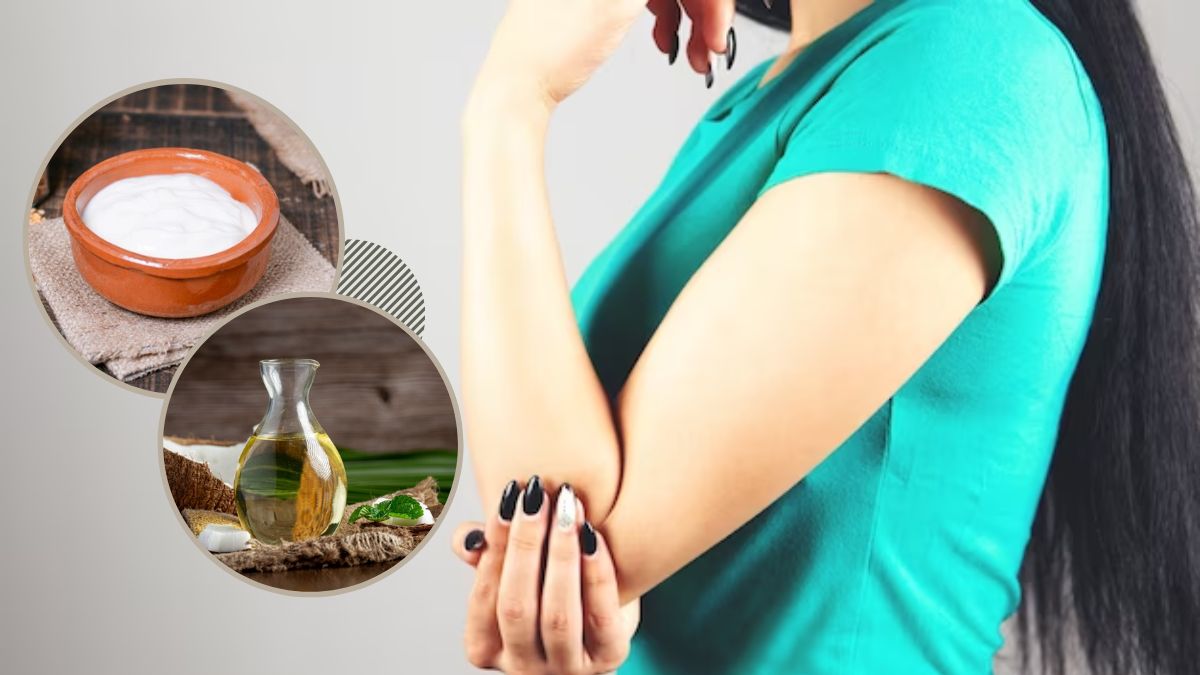 Dark Elbows Remedies: இந்த பொருள் போதும். இரண்டே வாரத்தில் முழங்கை கருமையை போக்கலாம்