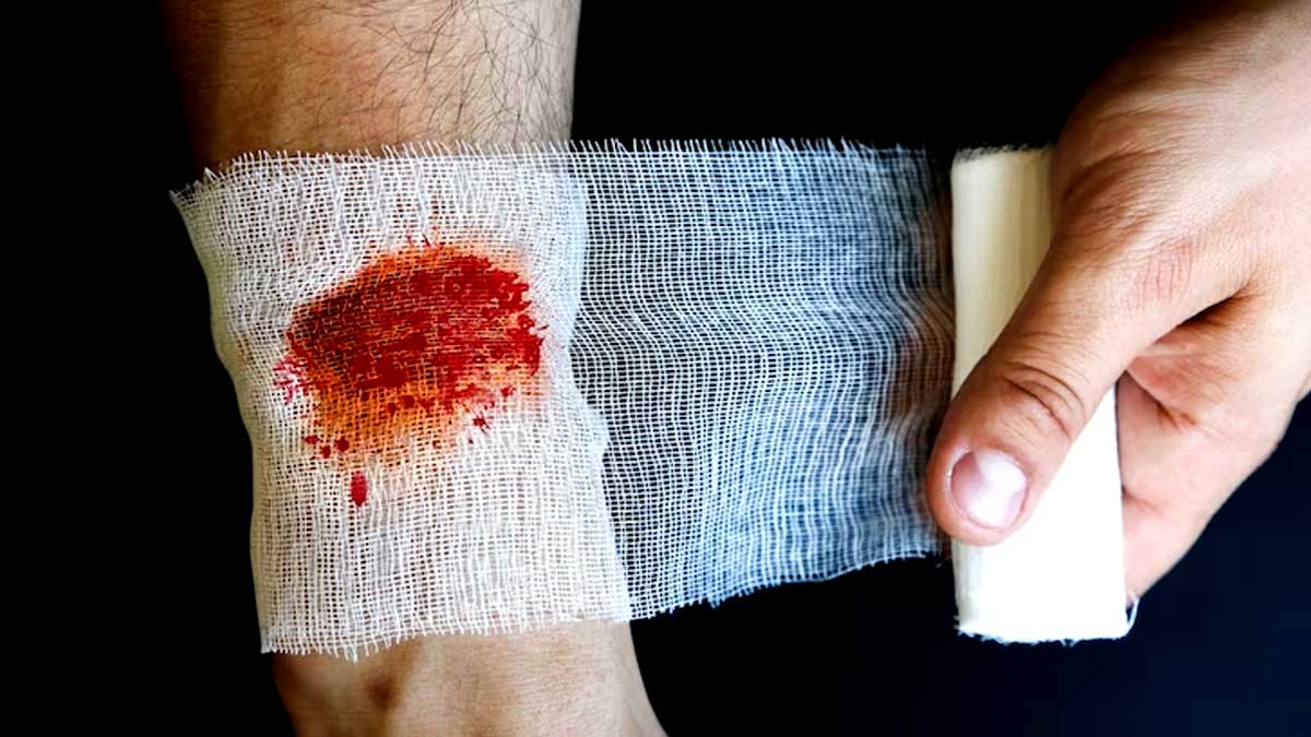Diabetic Wound Care: சர்க்கரை நோய் புண் வேகமா ஆற இதை மட்டும் பண்ணுங்க!