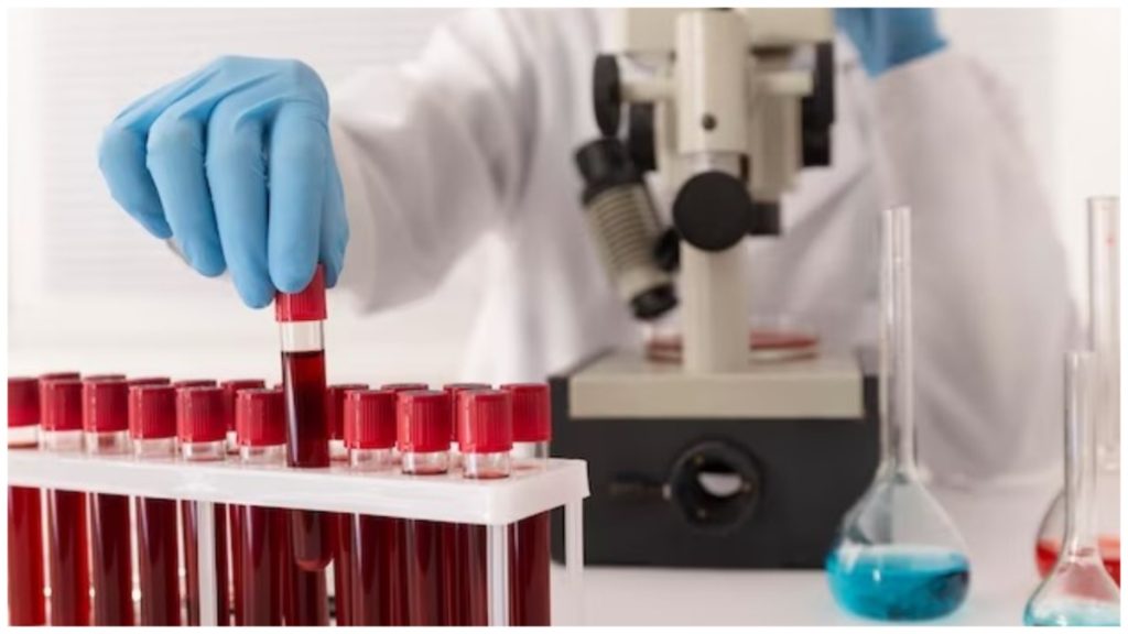 the-top-five-blood-tests-you-should-Include-in-your-annual-health-checkup