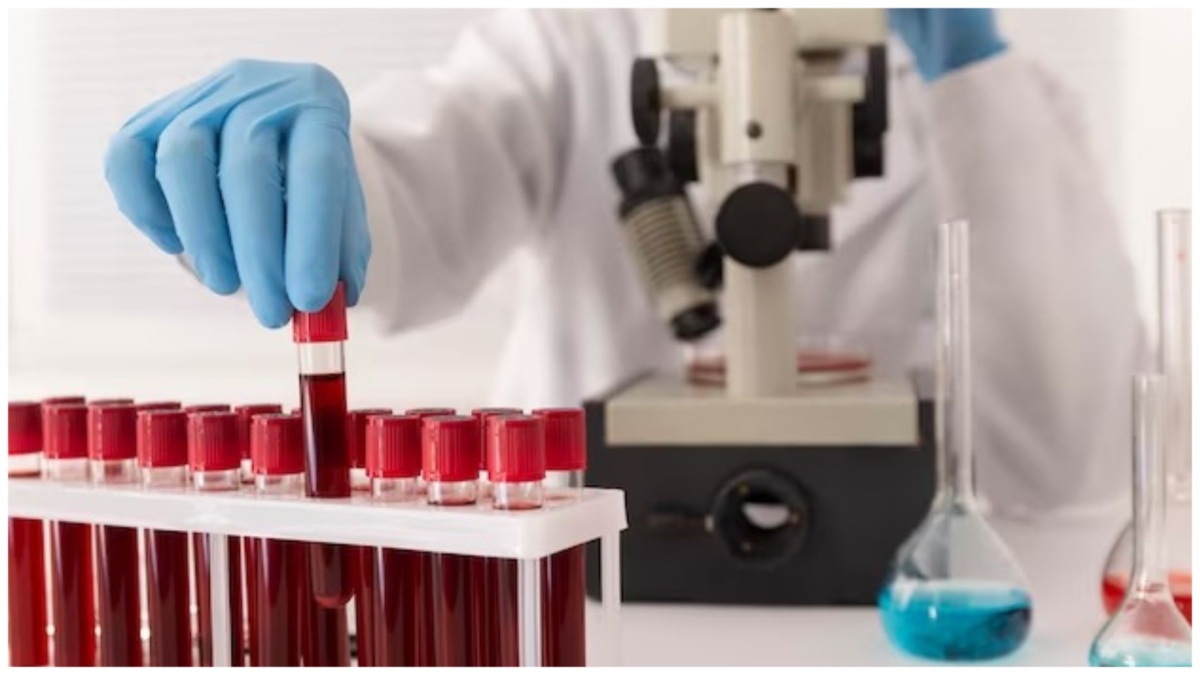 Blood Test Important: இளைஞர்கள் அடிக்கடி இரத்த பரிசோதனை செய்வது ஏன் முக்கியம்?