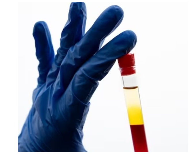 the-top-five-blood-tests-you-should-Include-in-your-annual-health-checkup