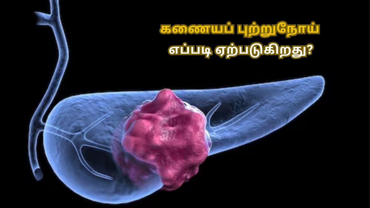 Pancreatic Cancer: கணையப் புற்றுநோய் எப்படி ஏற்படுகிறது?