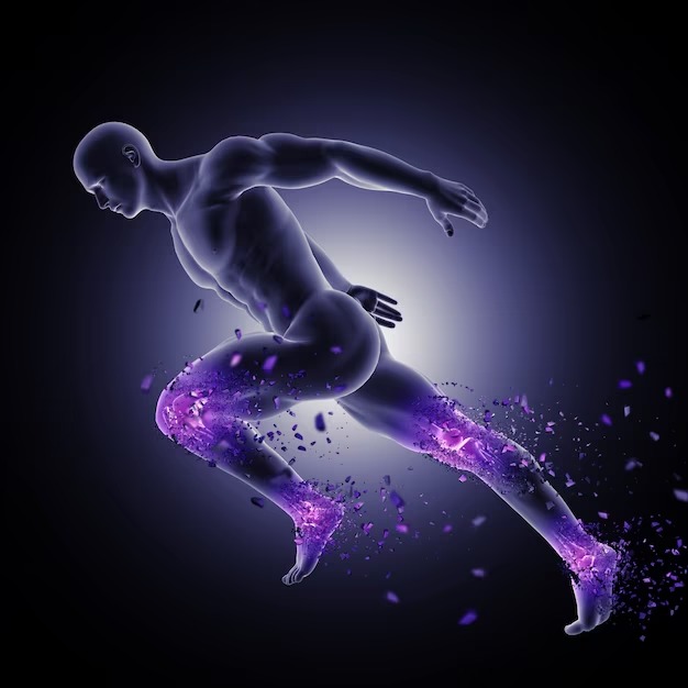fibromyalgia