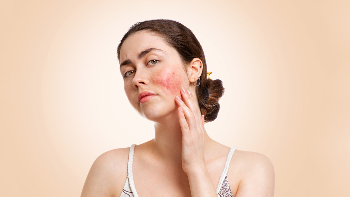 Sensitive Skin Care: உங்களுக்கு சென்சிடிவ் ஸ்கின்னா? இந்த பராமரிப்பு டிப்ஸை பின்பற்றுங்க!