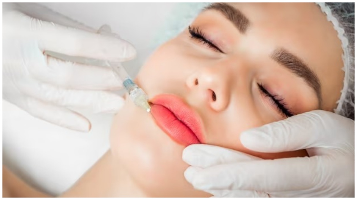 Lip Fillers எச்சரிக்கை… லிப் ஃபில்லர்ஸ் சிகிச்சை கேன்சரை உருவாக்குமா?