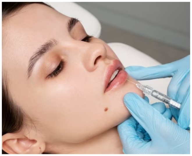 can-lip-fillers-cause-cancer