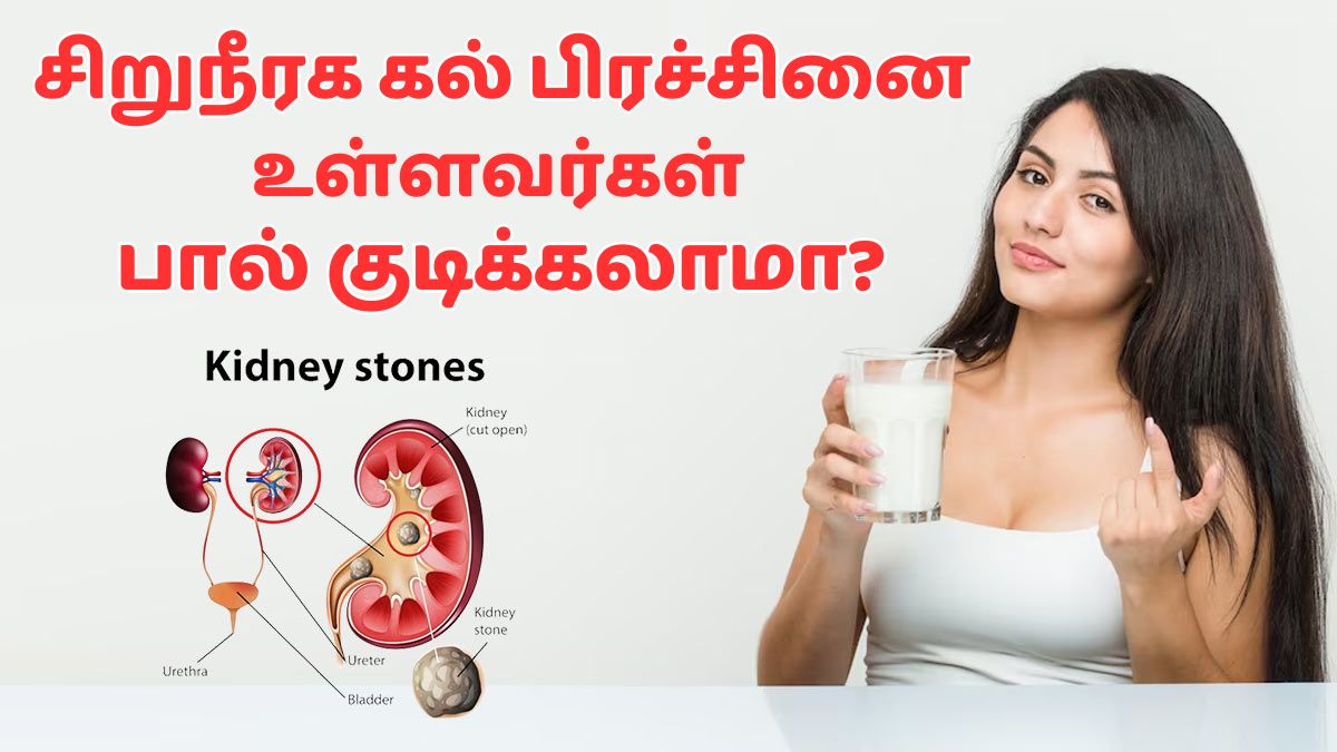 Kidney Stones: பால் குடித்தால் சிறுநீரக கல் பிரச்சினை அதிகரிக்குமா? டாக்டர் கூறுவது என்ன?