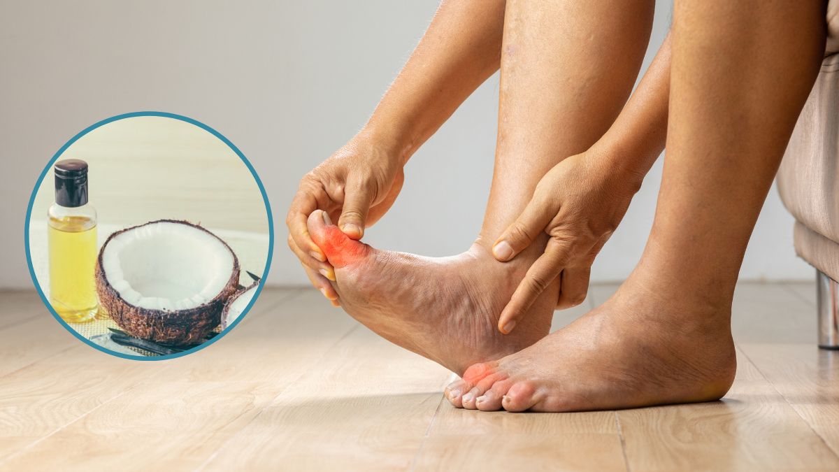Coconut Oil On Feet: பாதங்களில் இந்த பிரச்சனையா? தேங்காய் எண்ணெய் கொண்டு மசாஜ் பண்ணுங்க
