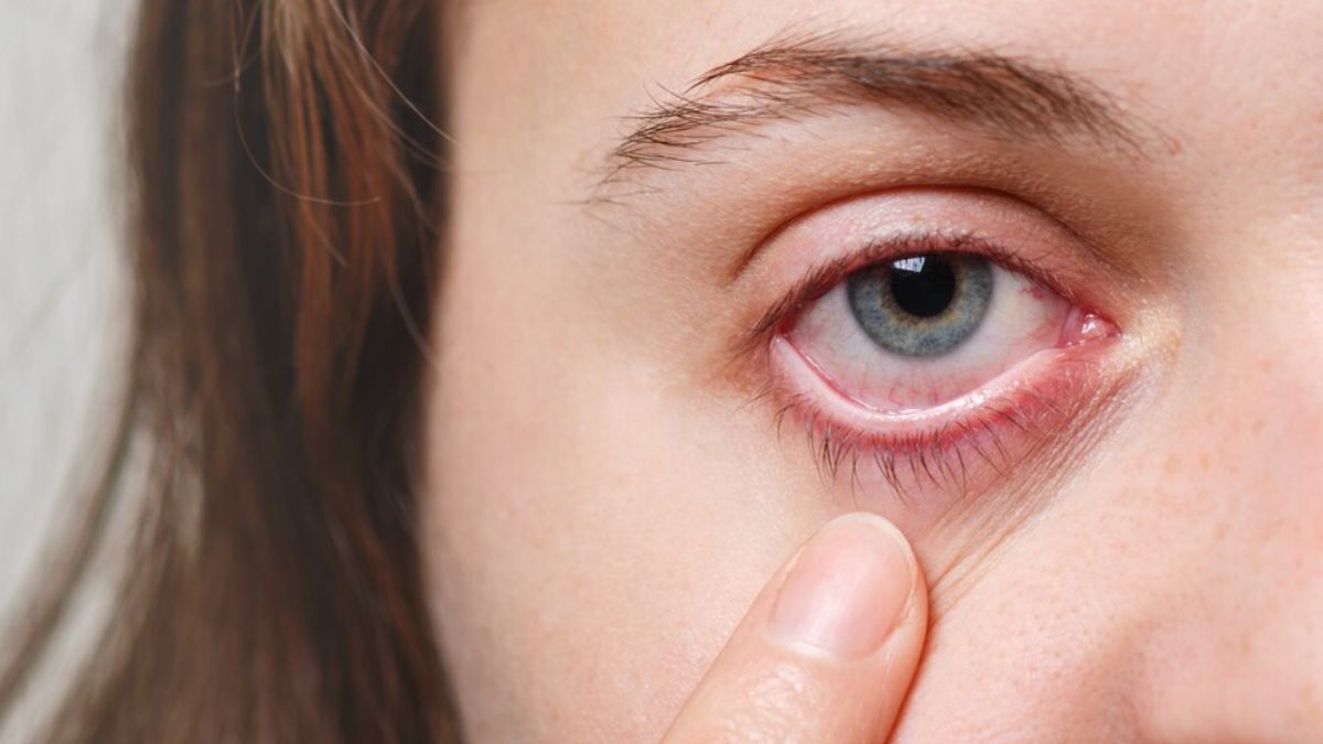 Eye Care: கவனம் தேவை: அதிகரித்து வரும் பார்வை குறைபாடு.. காரணமும் தீர்வும்!