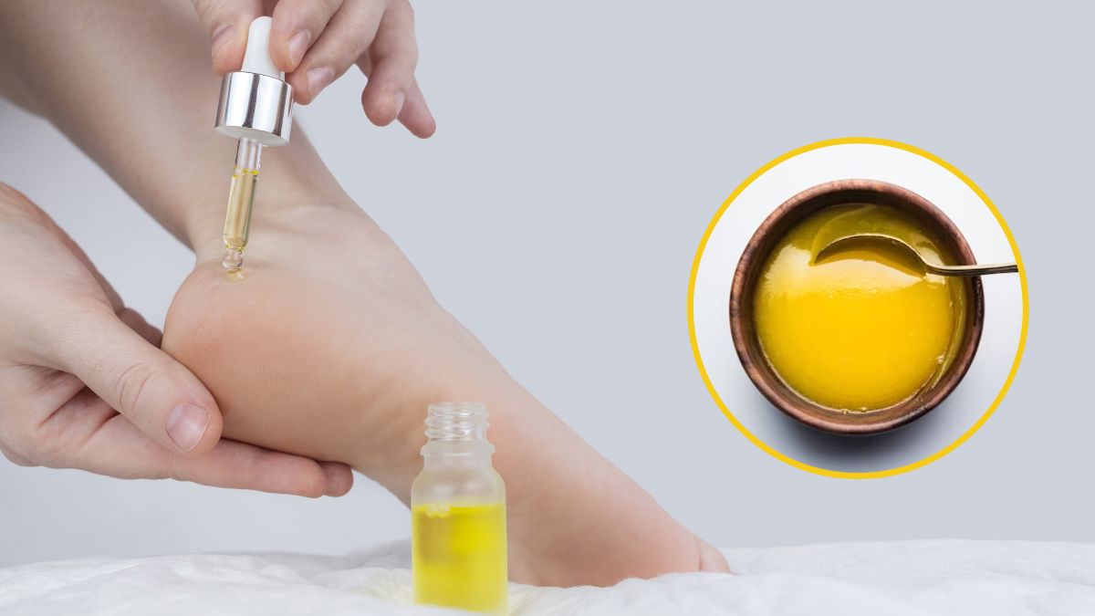 Ghee For Cracked Heels: பாத வெடிப்பால் ரொம்ப அவதியா? அதுக்கு இந்த இரண்டு பொருள்கள் போதும்