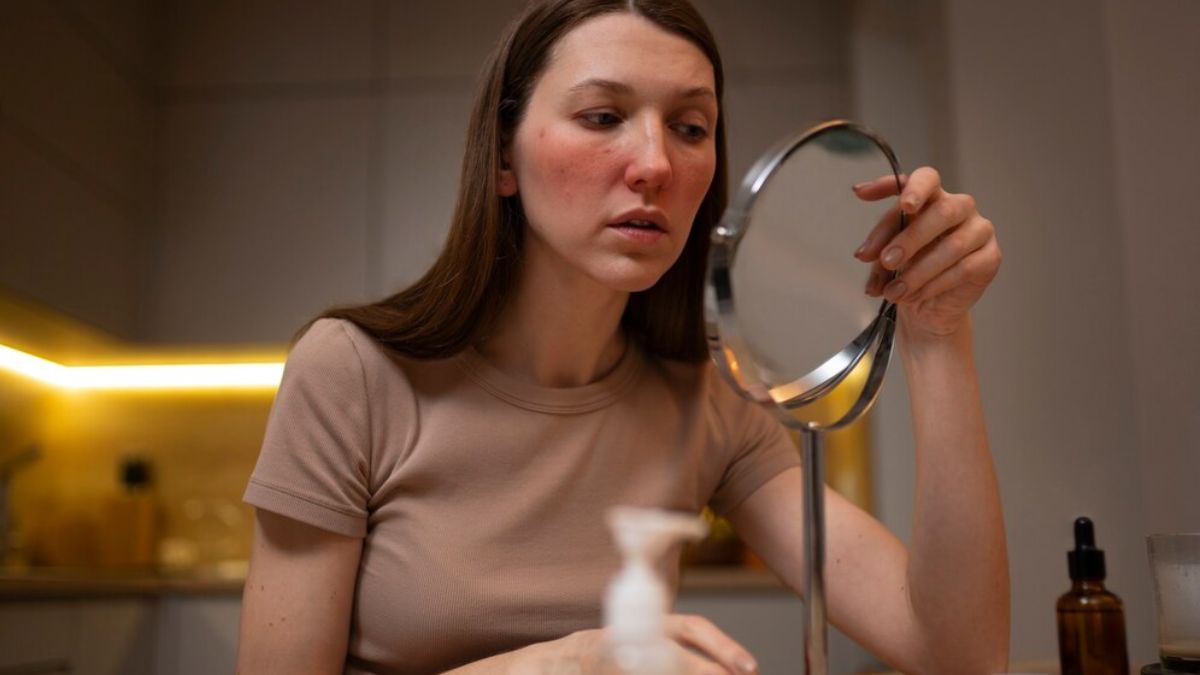 Hyperpigmentation: உங்கள் உடல் நிறத்தை விட முகம் கருமையாக இருப்பது ஏன் தெரியுமா? பதில் இங்கே!
