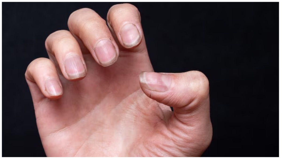 White Spots on Nails: நகம் இப்படி இருந்தா உங்க உடம்புல என்ன பிரச்னை இருக்குனு தெரியுமா?