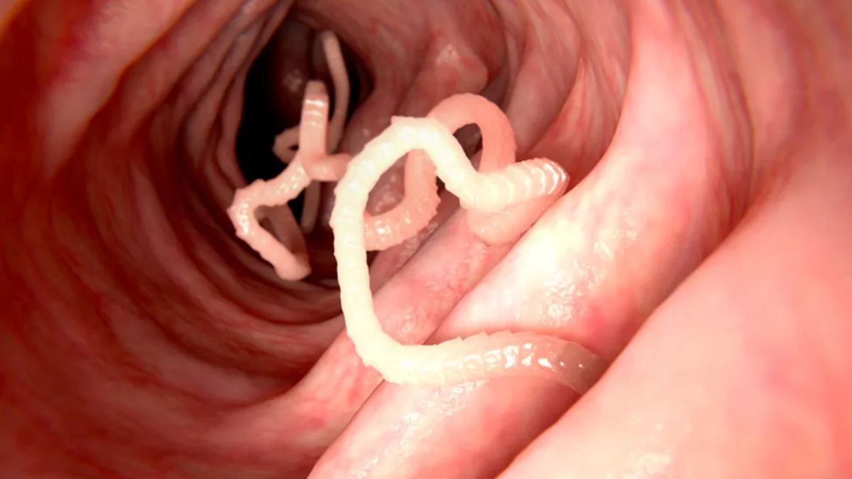 Stomach Worms Remedy: வயிற்றில் புழு இருக்கிறதா? இந்த சின்ன விதை போதும்.! சிறந்த நிவாரணம்…