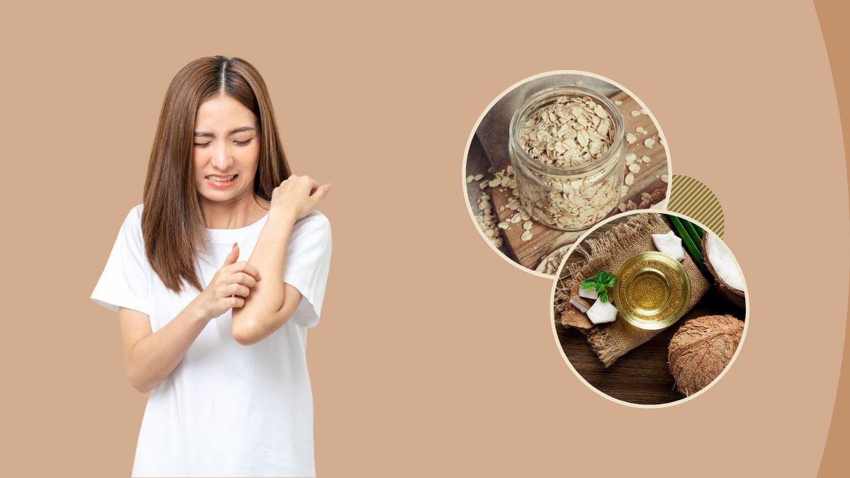Itchy Skin Remedies: கோடைக்காலத்தில் சரும அரிப்பைத் தடுக்க உதவும் வீட்டு வைத்தியங்கள் இதோ