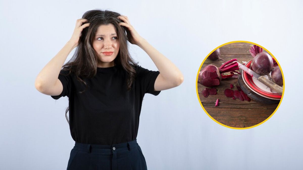Beetroot Peel For Hair: பொடுகு தொல்லையிலிருந்து விடுபட பீட்ரூட் தோலை இப்படி யூஸ் பண்ணுங்க