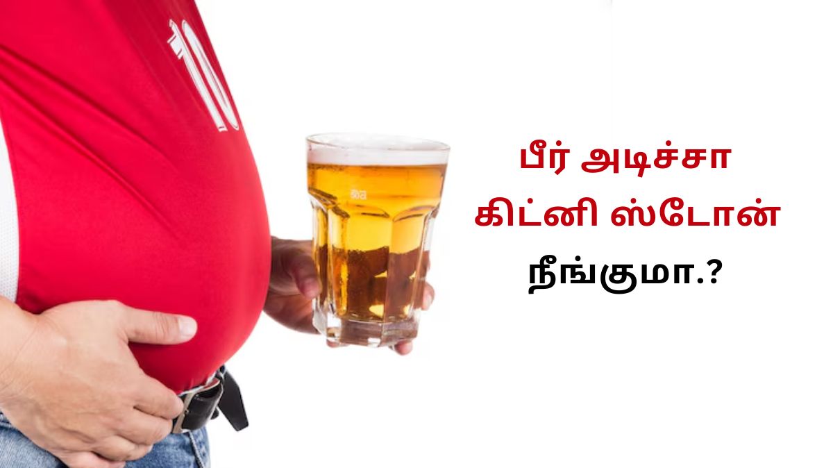 Beer For Kidney: பீர் அடிச்சா கிட்னி ஸ்டோன் நீங்குமா.? உண்மை என்ன.?