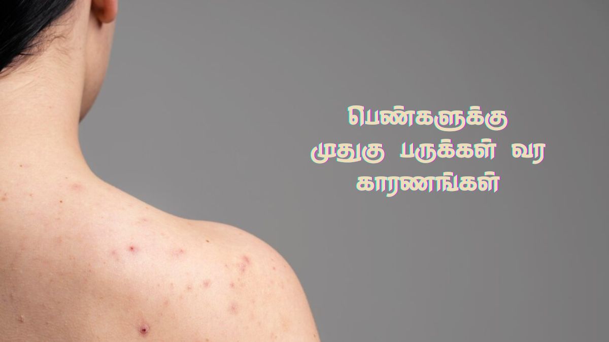 Back Acne Causes: பெண்களே! முதுகு பருக்கள் ஏற்பட என்னென்ன காரணம் இருக்கு தெரியுமா?