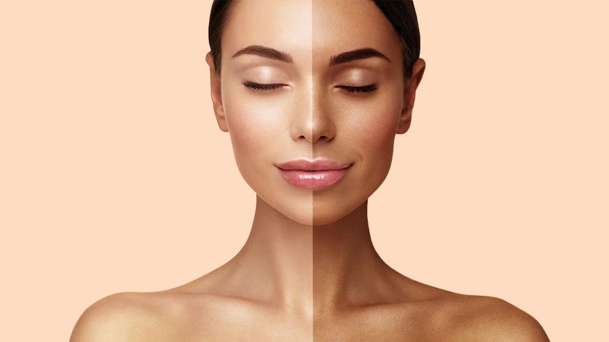 Vitamins for Hyperpigmentation: உங்க சருமம் திடீர் என கருமையாக இந்த வைட்டமின் குறைபாடுதான் காரணம்!