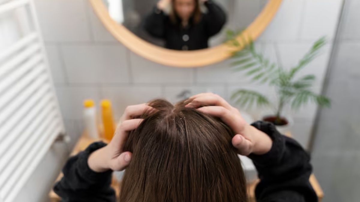 Scalp Care: உச்சந்தலை அரோக்கியத்திற்கு இதை ஃபாளோ பண்ணவும்.!