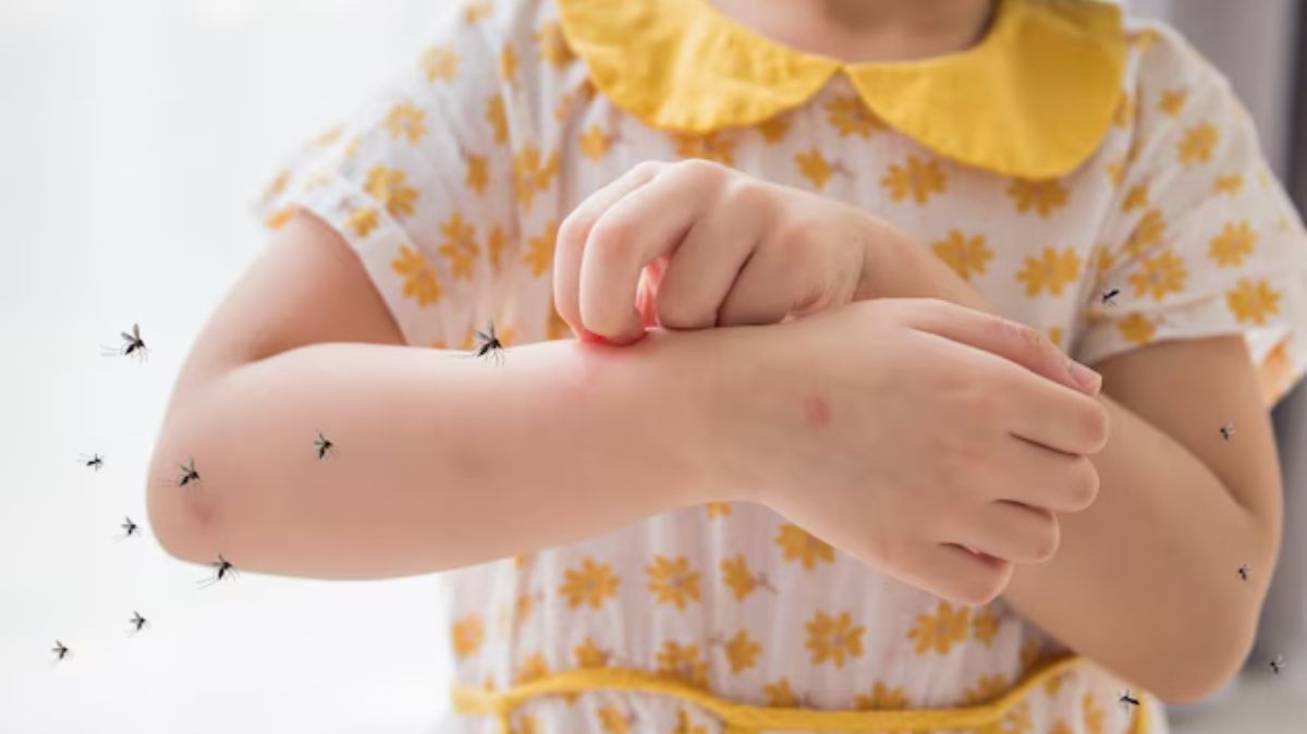 Hyderabad Chikungunya Cases: குழந்தைகளை குறிவைக்கும் சிக்குன்குனியா.. தடுப்பு நடவடிக்கை இங்கே..