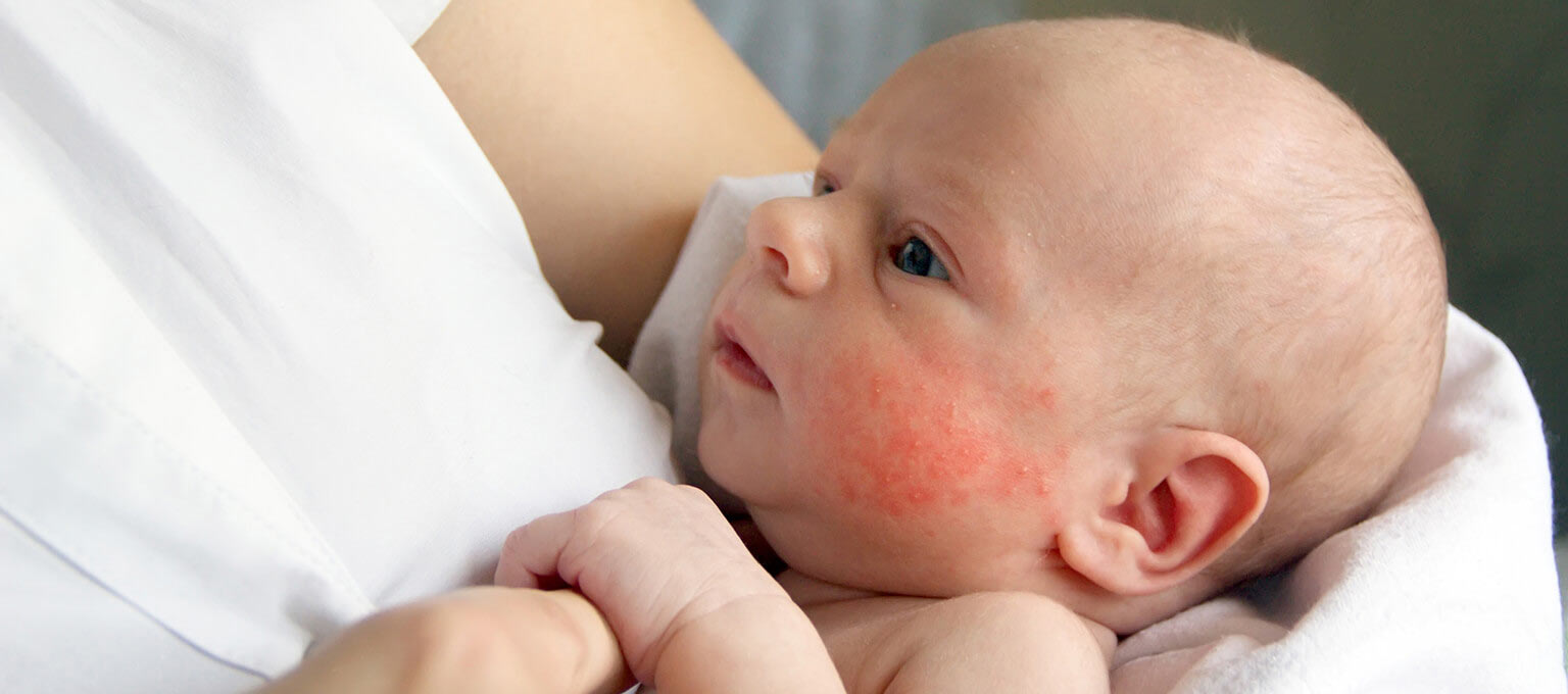 Mosquito Bites: கொசுக்கடியில் இருந்து குழந்தைகளை பாதுகாக்க உதவும் எளிய வீட்டு வைத்தியம்!!