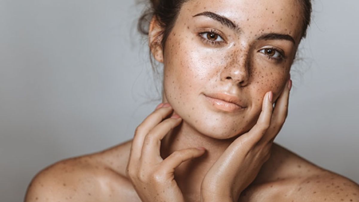 Pigmentation Remedies: முகமெல்லாம் கருப்பு கருப்பா இருக்கா? இந்த ஐந்து பொருள்கள் போதும்!